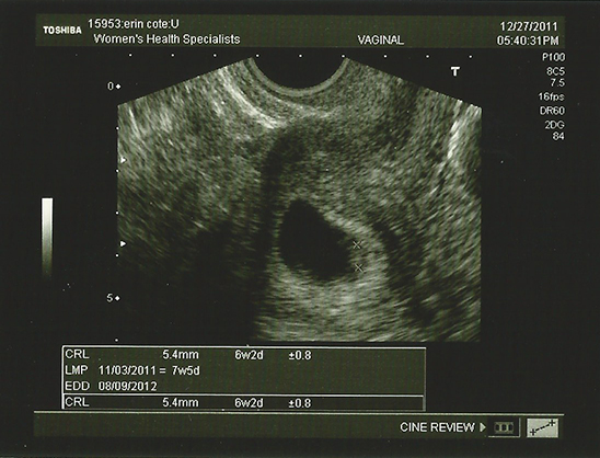 6-month-ultrasound.jpg